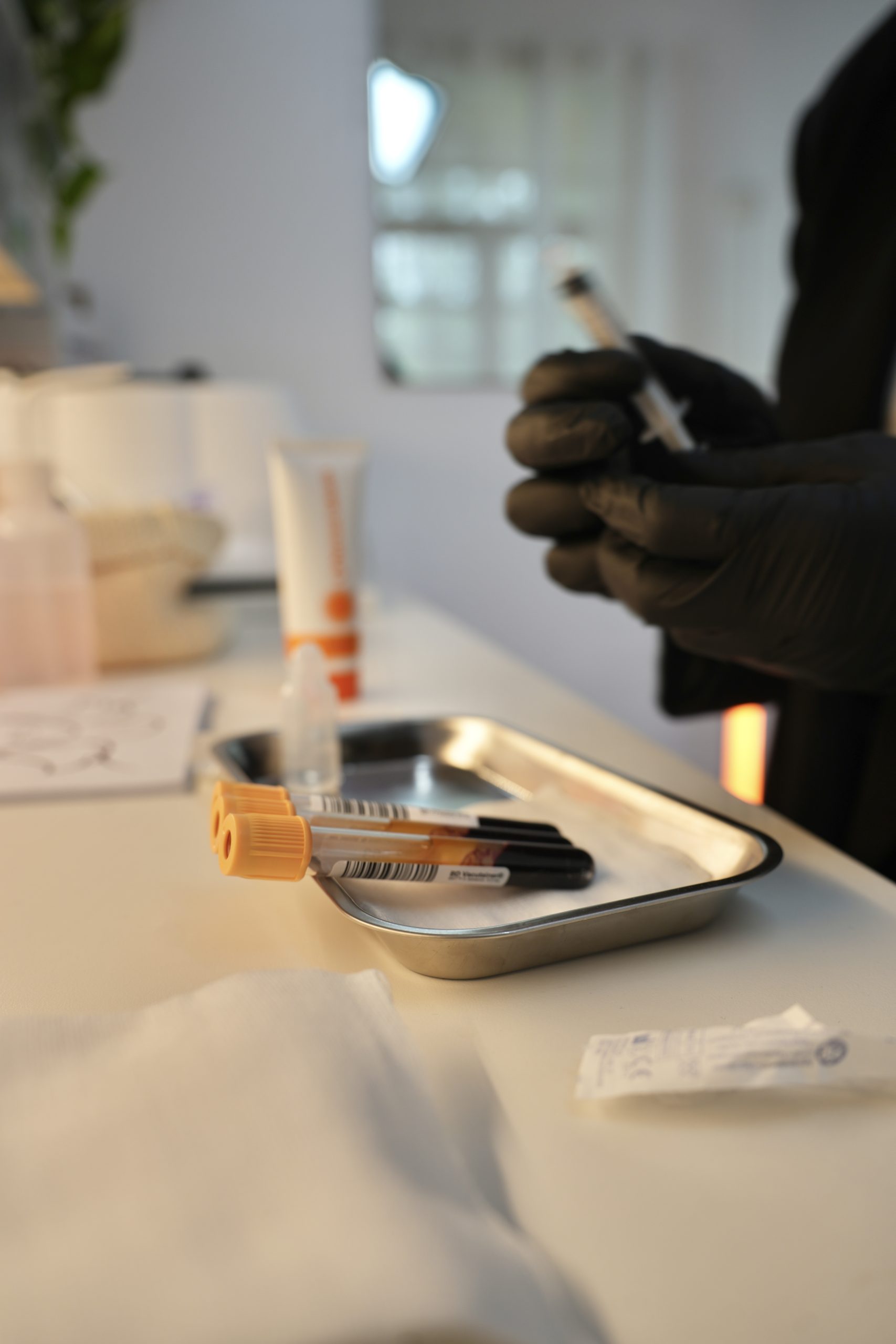 PRP למניעת התקרחות ולחיזוק השיער